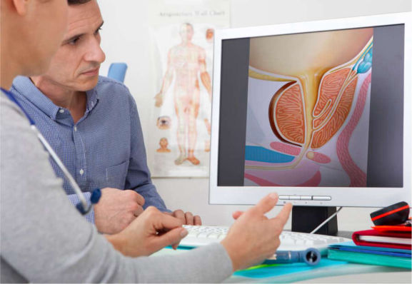 Tumores em Urologia